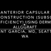 Dr. Garcia demonstrates his advanced technique for failed subscapularis repairs called an Anterior Capsular Reconstruction