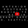 Dr. Garcia demonstrates his complex repair of a rare anterior and
posterior radial meniscus tear in a high level soccer player