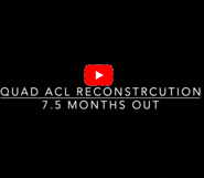 7 months after Quad ACL Reconstruction